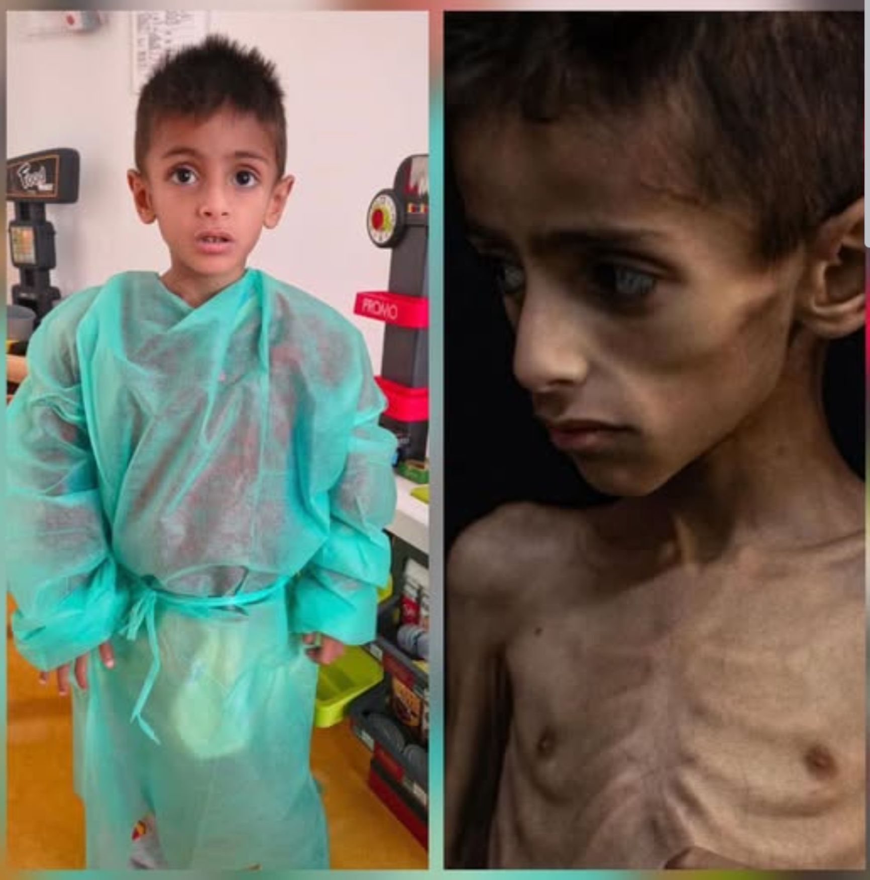 Осама-аль-Ракаб после и до лечения